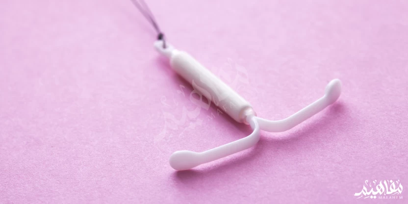 اللولب الهرموني اللولب الهرموني