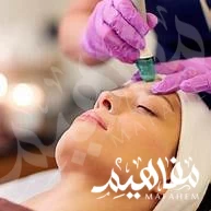 Chemical Peel Chemical Peel