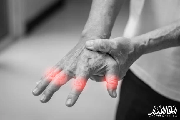 تنميل-اليدين-أثناء-النوم تنميل-اليدين-أثناء-النوم