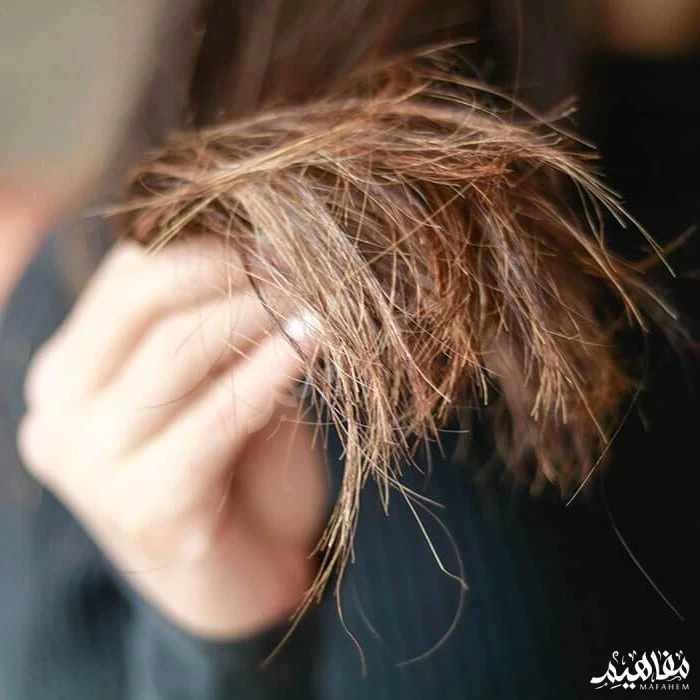 ديرمفيت وتقصف الشعر ديرمفيت وتقصف الشعر