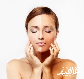 ديرمفيت للتبيض ديرمفيت للتبيض