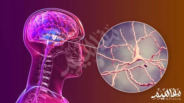 شلل رعاش شلل رعاش