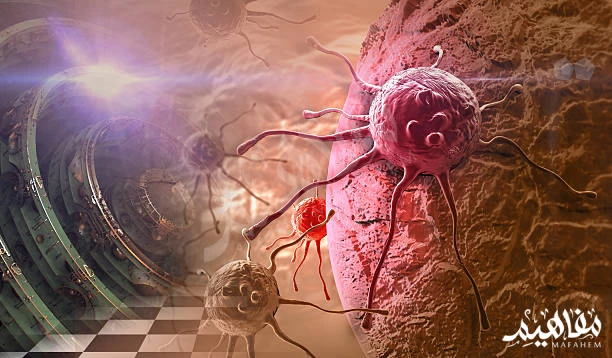 سرطان البنكرياس سرطان البنكرياس