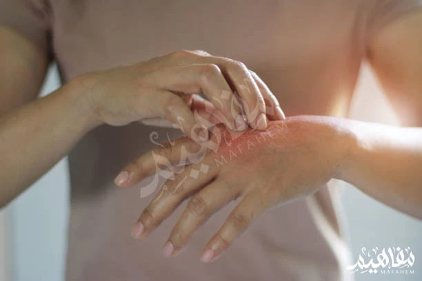 جرق من الدرجة الأولى جرق من الدرجة الأولى