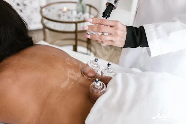 فوائد الحجامة فوائد الحجامة