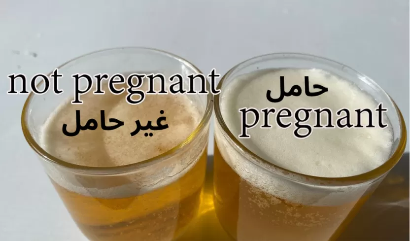 شكل رغوة تحليل الحمل بالكلور شكل رغوة تحليل الحمل بالكلور