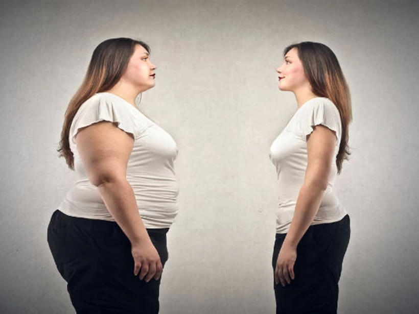 السمنة المفرطة السمنة المفرطة