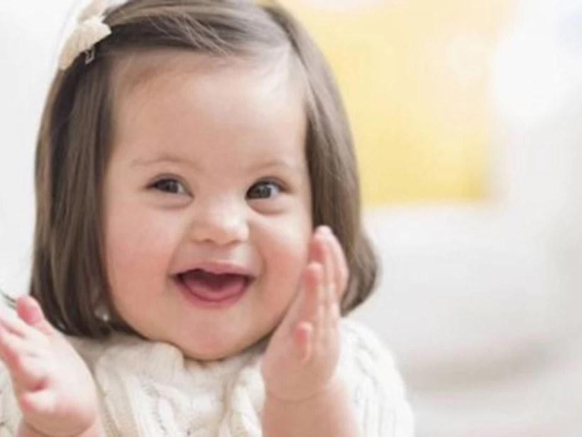 متلازمة-داون متلازمة-داون