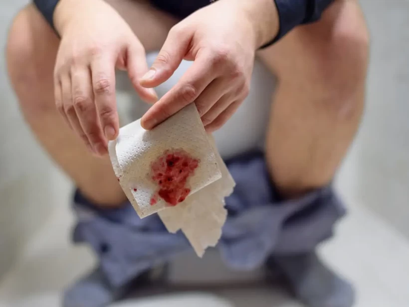 وجود الدم في البراز وجود الدم في البراز